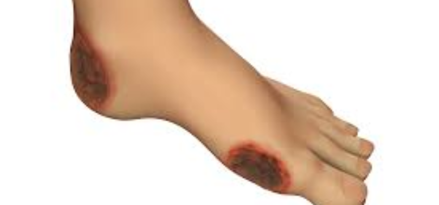 Minimally invasive Gynecological Surgeries